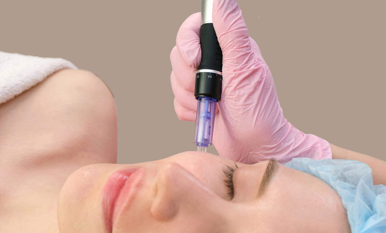 Does-microneedling-make-face-look-younger