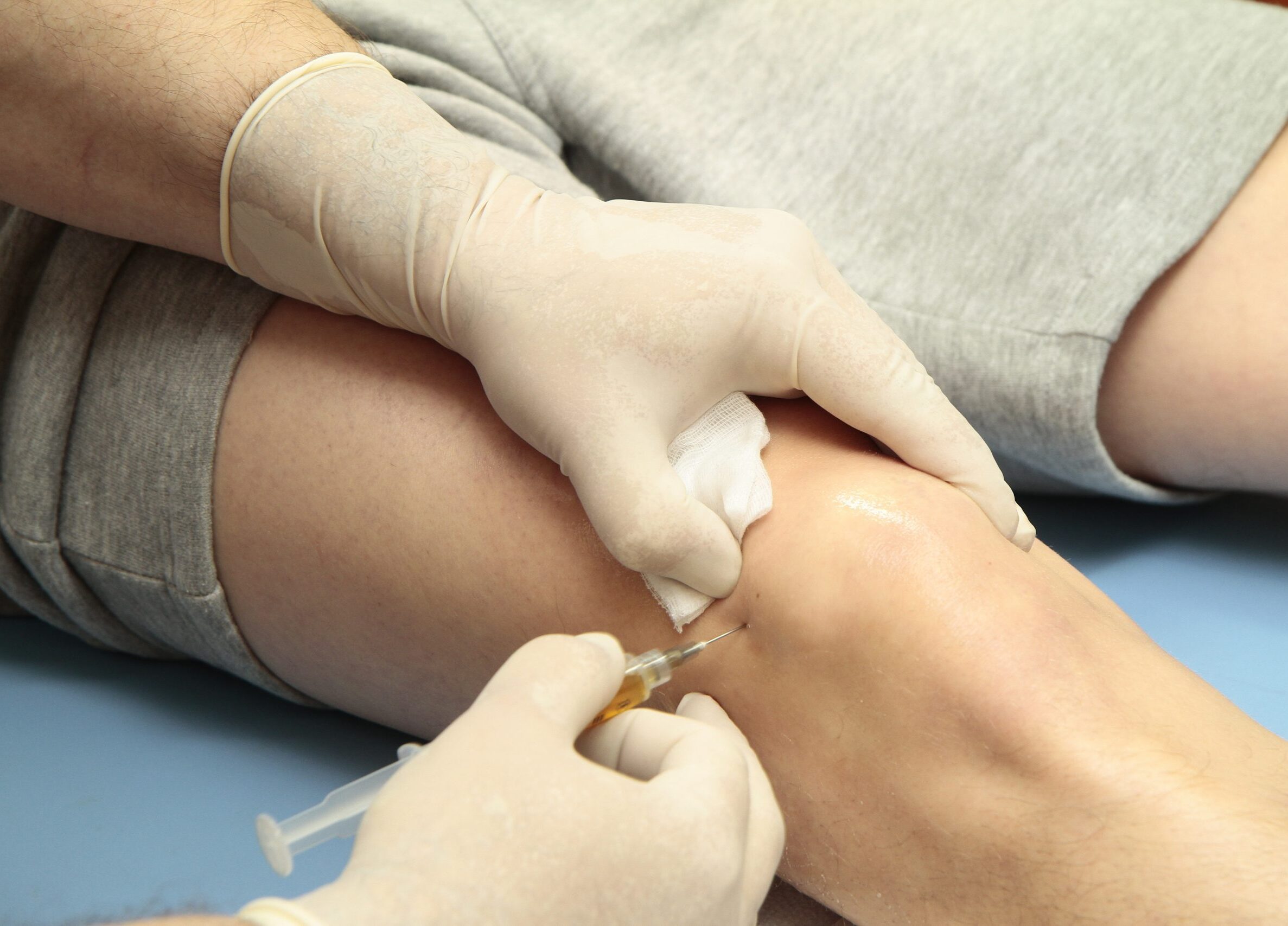 Stem-Cell-Therapy-for-Knees